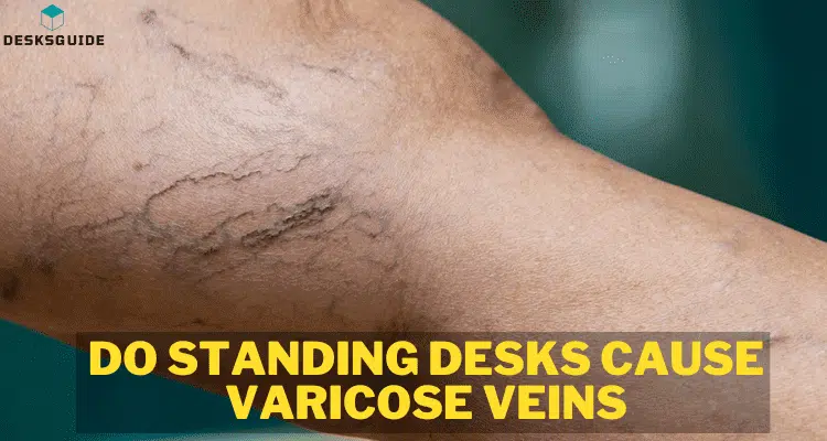 Do Standing Desks cause Varicose Veins - Featured Image
